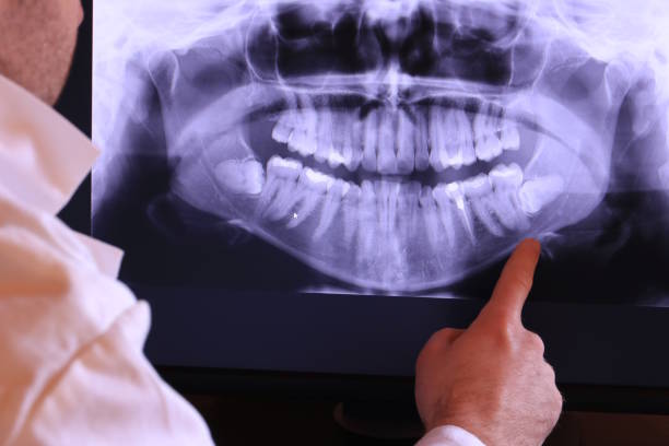 Best Pediatric Emergency Dentist in West Ishpeng, MI