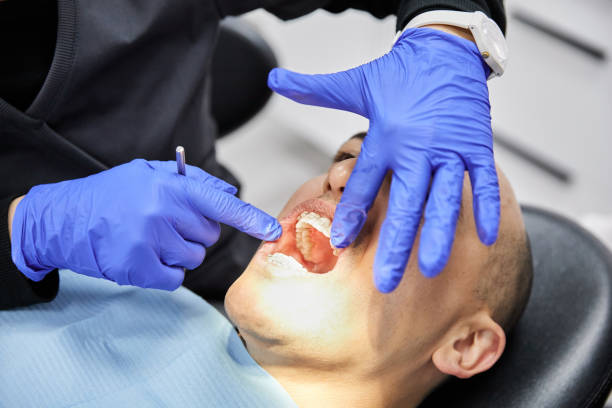 Best Emergency Dental Care for Trauma or Injury in West Ishpeng, MI